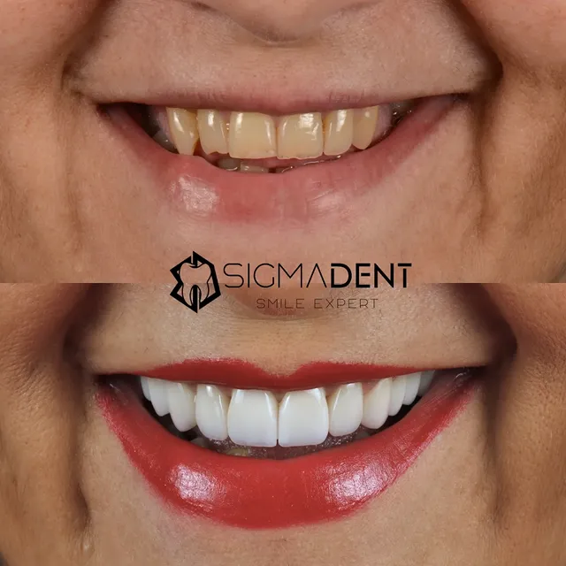 Dodatni primer rada 1